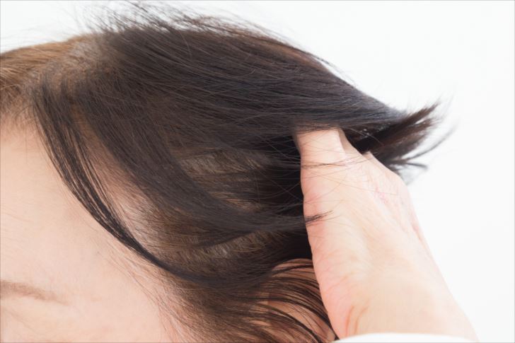 50代女性の薄毛の原因と対策方法